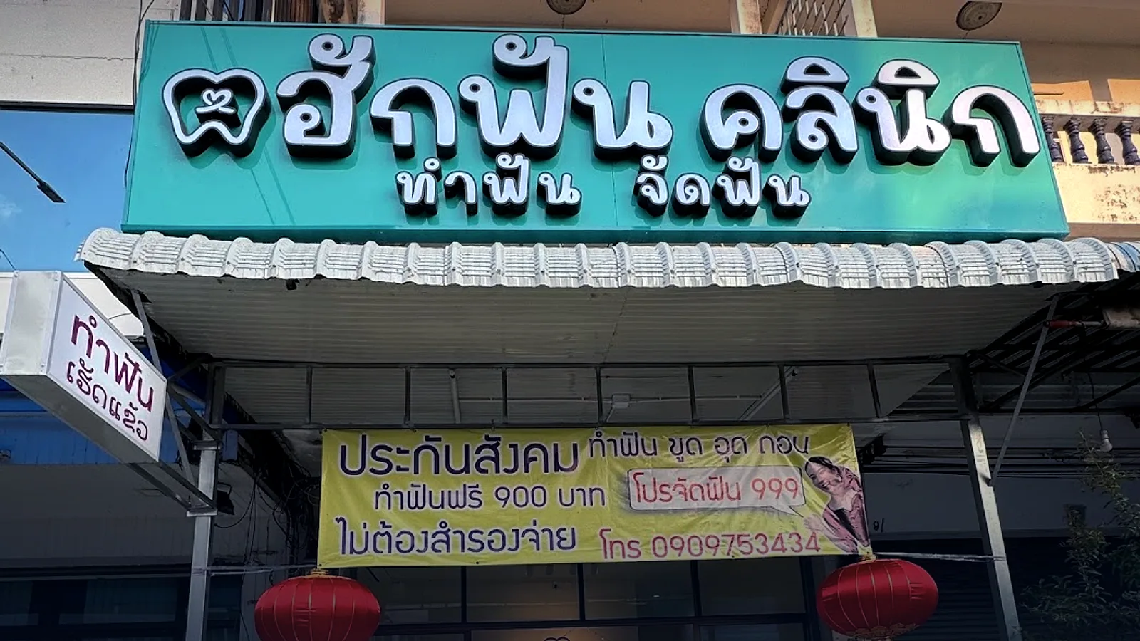 หักฟัน